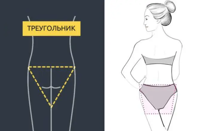 Сідниці в формі трикутника