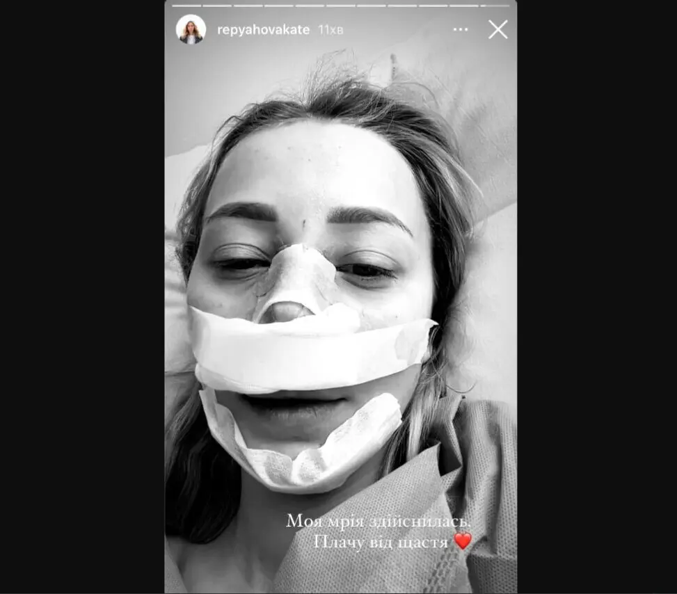 Катерина Репяхова наважилась на ринопластику Катерина Репяхова наважилась на ринопластику