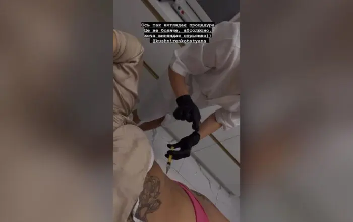 Олександра Заріцька з гурту KAZKA показала, як робить уколи краси