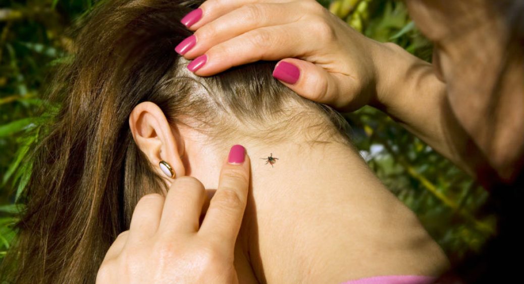 Як правильно і безпечно витягти кліща в домашніх умовах 