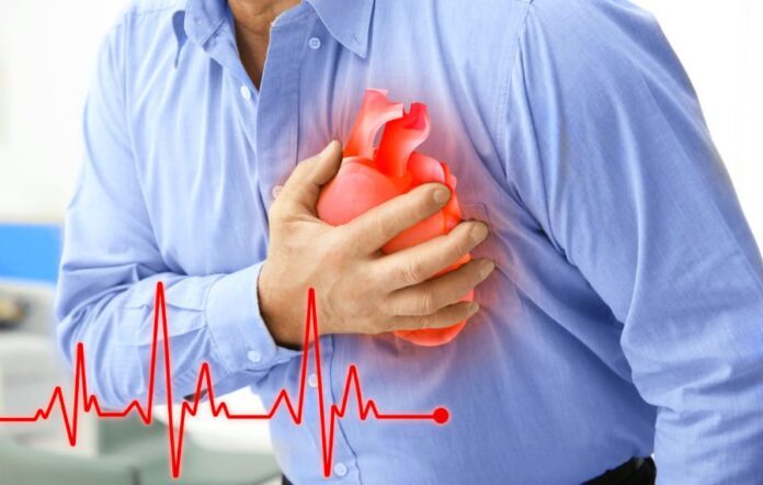 Симптоми інфаркту міокарда