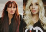 Пластический хирург об операциях Светланы Лободы. Фото до и после пластики (1) 