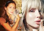 Светлана Лобода до и после пластики 