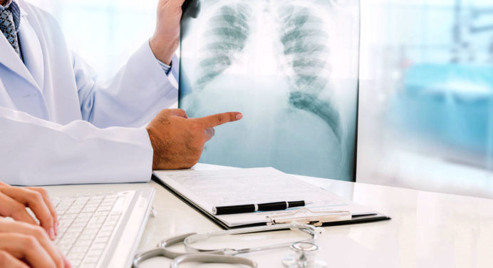 Поради пульмонологів про те, як самостійно визначити стан легенів 