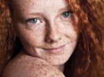 Freckles-and-pigmentation-e1458173451367-600×449 