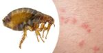 Укус блохи 