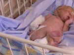 На Полтавщине родилась девочка «без кожи», от которой отказались родители (4) 