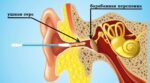 Почему нельзя чистить уши ватными палочками и нужно ли вообще это делать (3) 