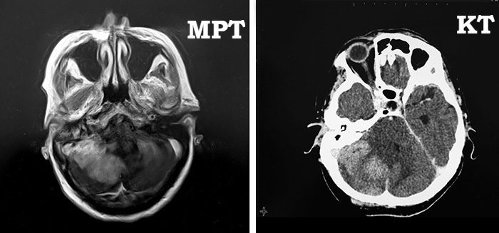 Снимок головы при МРТ и при КТ