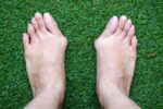 1800ss_getty_rf_bunions 