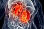 1800ss_thinkstock_rf_kidney_inflammation 