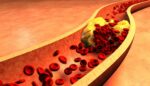 hdl-cholesterol 