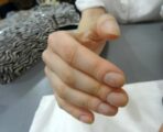 Как определить проблемы по здоровьем по ногтям 5 болезней, на которые указывает ваш маникюр (3) 