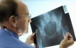 osteoporoz-lechenie 