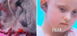 Проект «Я стесняюсь своего тела» помогает и детям юные участники до и после лечения (4) 