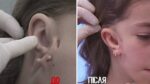 Проект «Я стесняюсь своего тела» помогает и детям юные участники до и после лечения (8) 