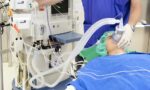 Виды наркоза какая бывает анестезия и как правильно выбрать подходящую (2) 