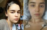 Звезды, которые выжили после страшных операций Анжелина Джоли, Оззи Осборн и другие (5) 