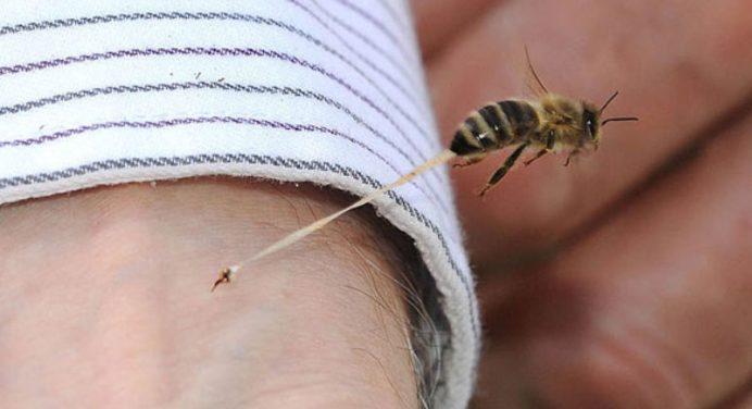 Перша допомога при укусі бджоли і коли варто викликати швидку 