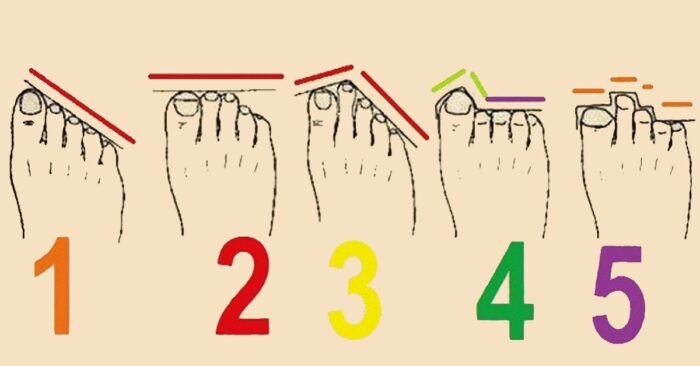 5 типів форми пальців ніг, які можуть розповісти про вас дещо особливе