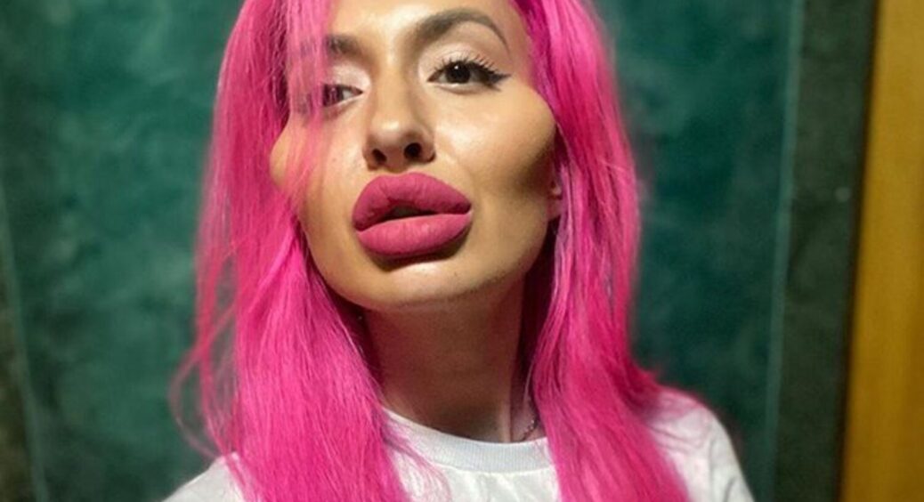 33-річна дівчина з гігантськими вилицями показала фото до пластики: слів не підібрати 