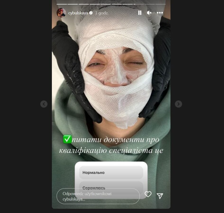 Ольга Цибульська здивувала прихильників перебинтованим обличчям