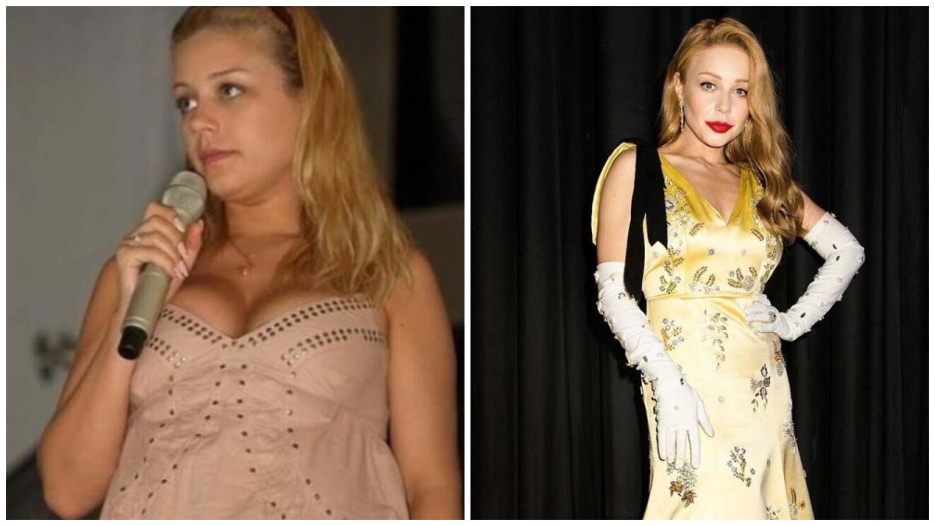 Тіна Кароль до та після схуднення