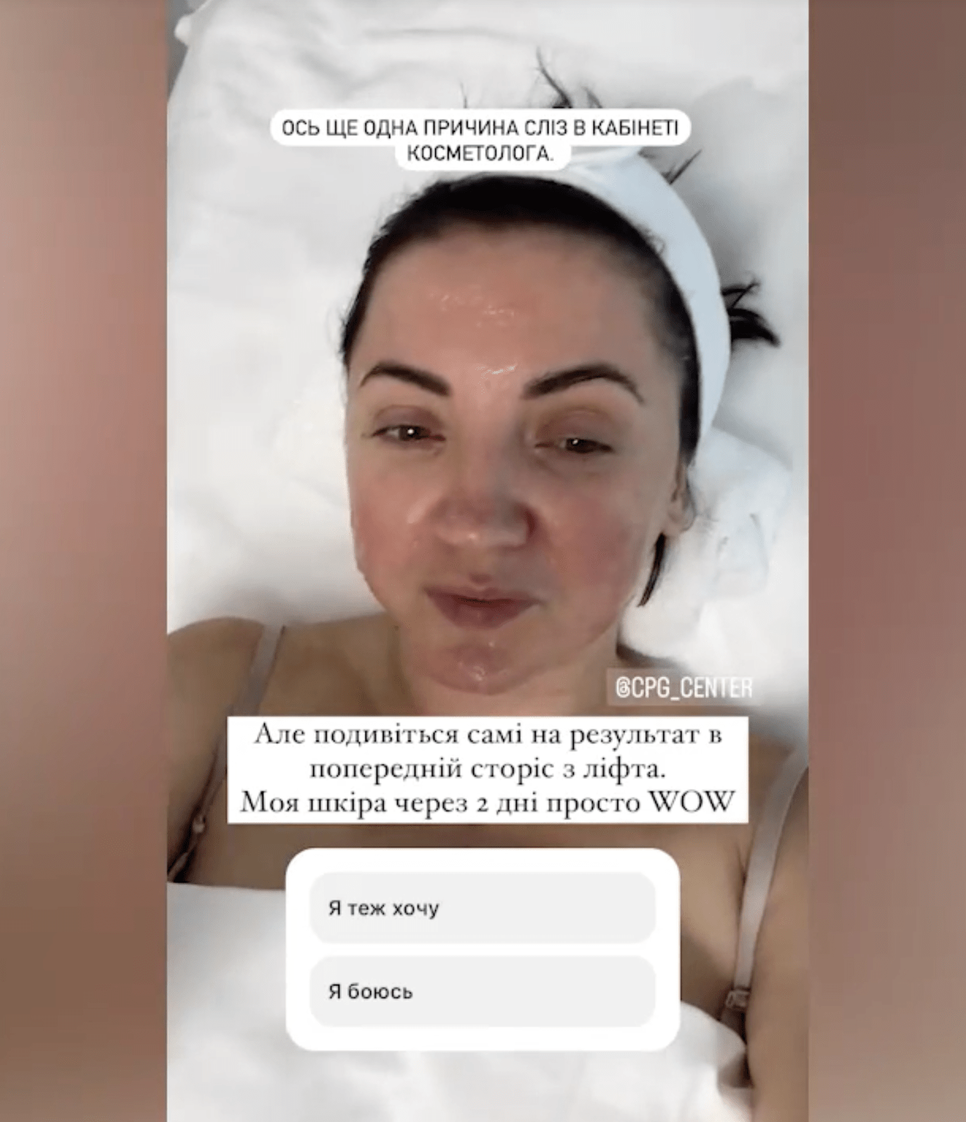 Ольга Цибульська показала результати косметологічного втручання