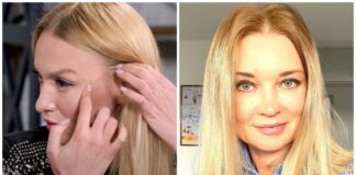 Дорофєєва, Полякова, Камалія та інші зірки, які мають відмітини на тілі