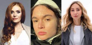 Які пластичні операції робили українські зірки