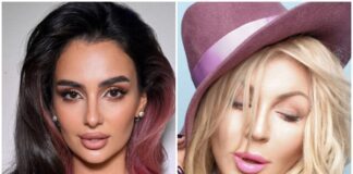 Як виглядали українські зірки до та після пластики