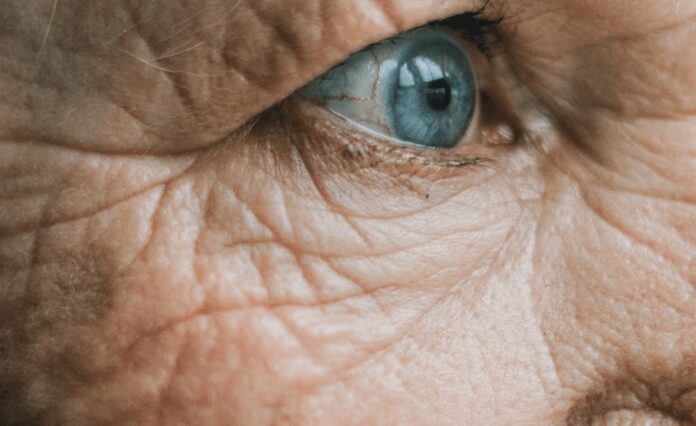 Як заощадити на дорогій косметиці від зморшок на обличчі Як заощадити на дорогій косметиці від зморшок на обличчі