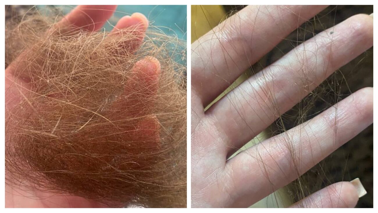 Експерти розповіли, які трави допоможуть зупинити сезонне випадіння волосся 