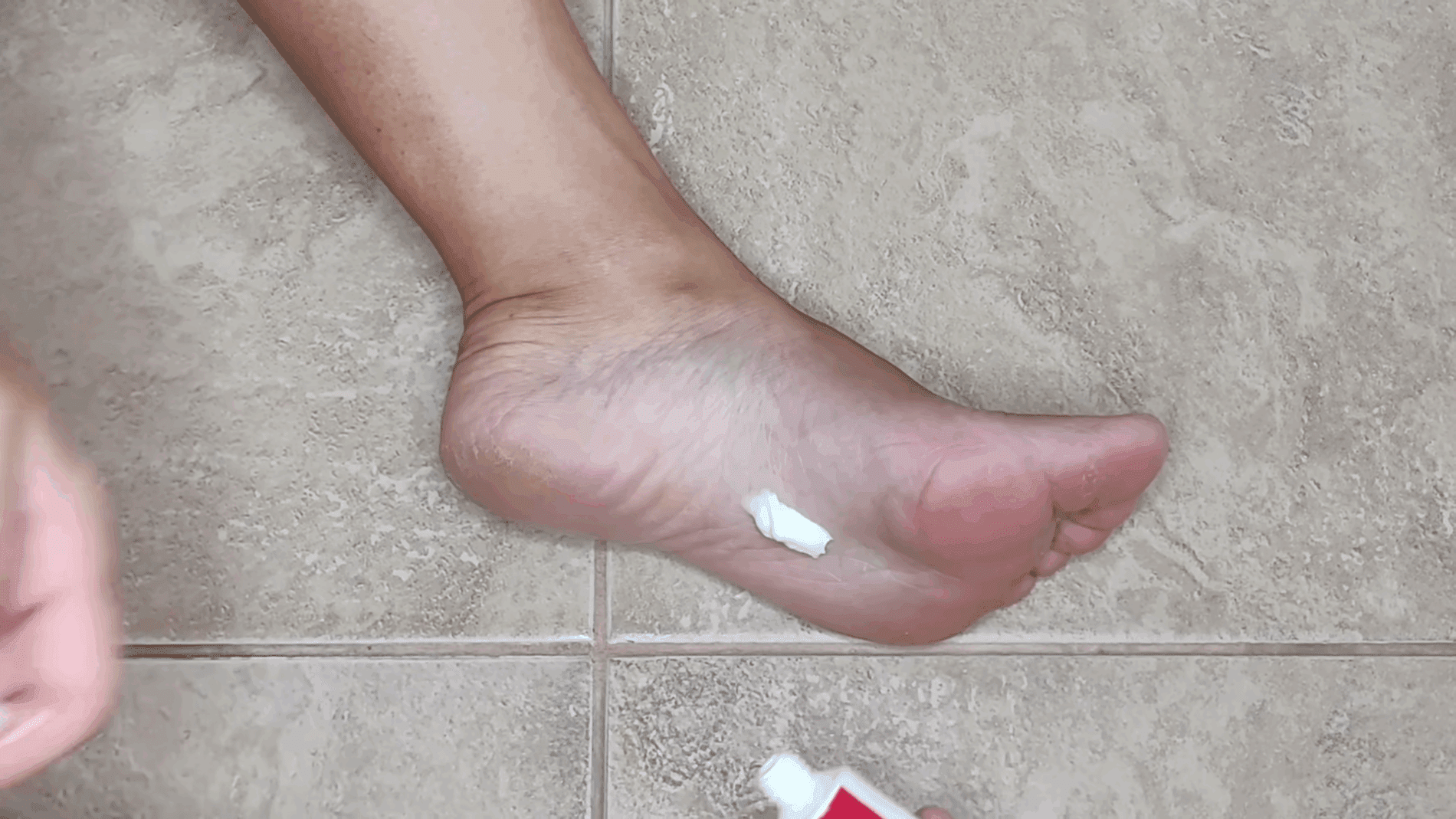 Експерти розповіли, як зробити шкіру стоп м'якою