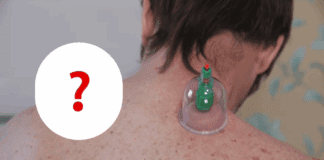 Експерти розповіли, чи є корисним масаж спини банками 