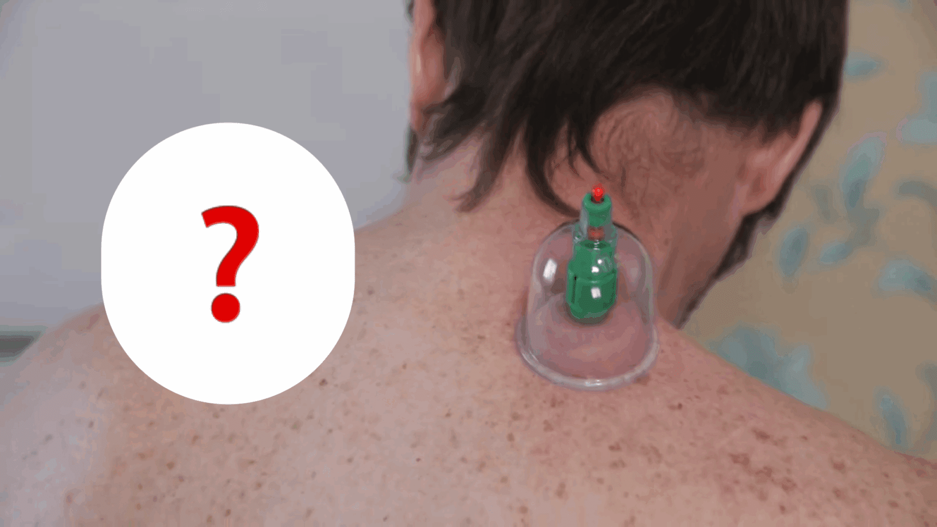 Експерти розповіли, чи є корисним масаж спини банками 