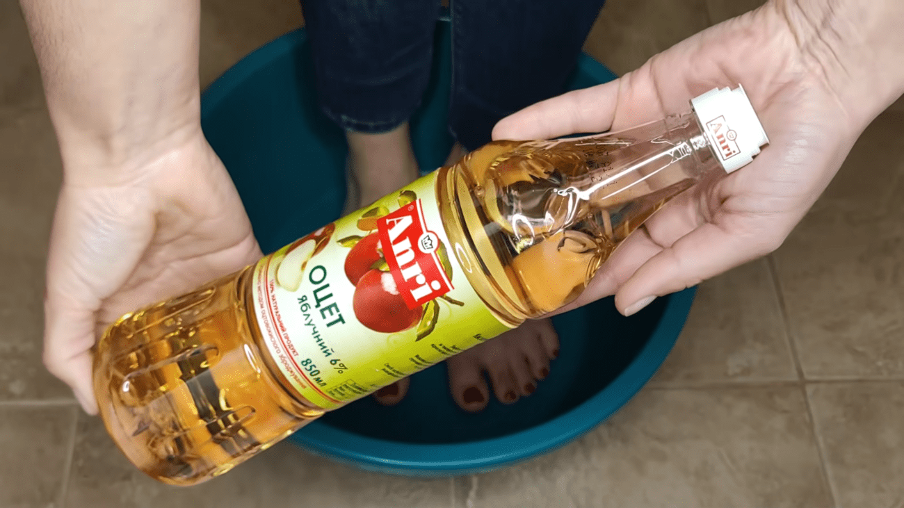 Експерти розповіли, навіщо робити ванночки для ніг з оцтом