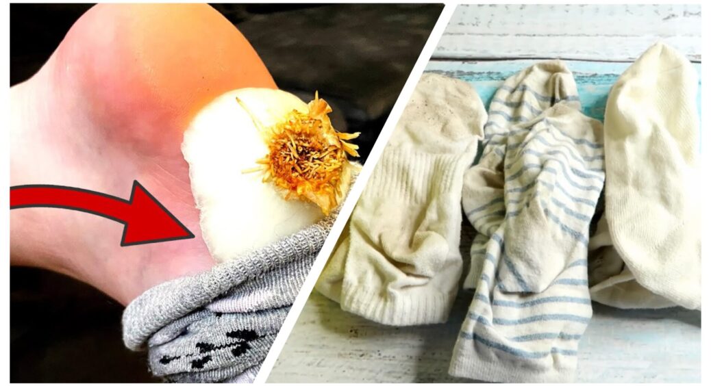 Одні кладуть в шкарпетки цибулю, інші – відправляють брудні шкарпетки в мікрохвильовку: що це за лайфхаки 