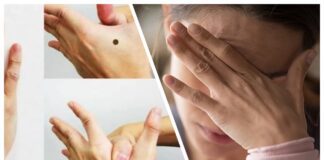 Фахівці розповіли, як позбутися головного болю без таблеток 