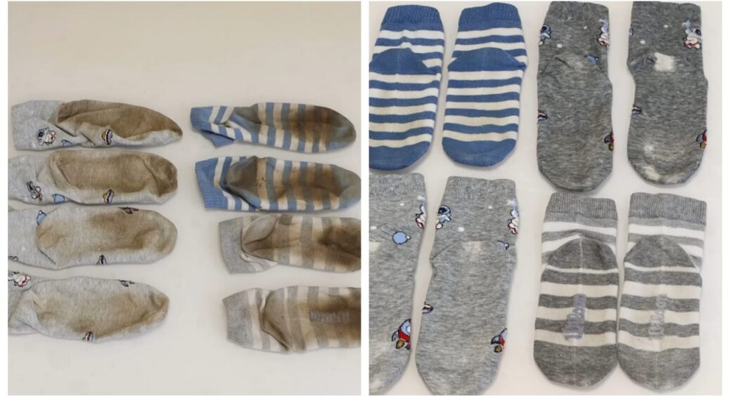 Вода стала темною вже за хвилину – це засіб витягнув бруд і волокон: спосіб відіпрати шкарпетки на всі 100 