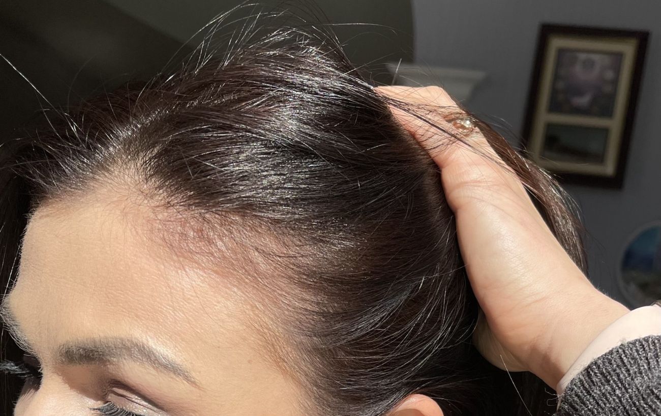 Експерти порадили, як приготувати домашній лосьйон для росту волосся — проста порада