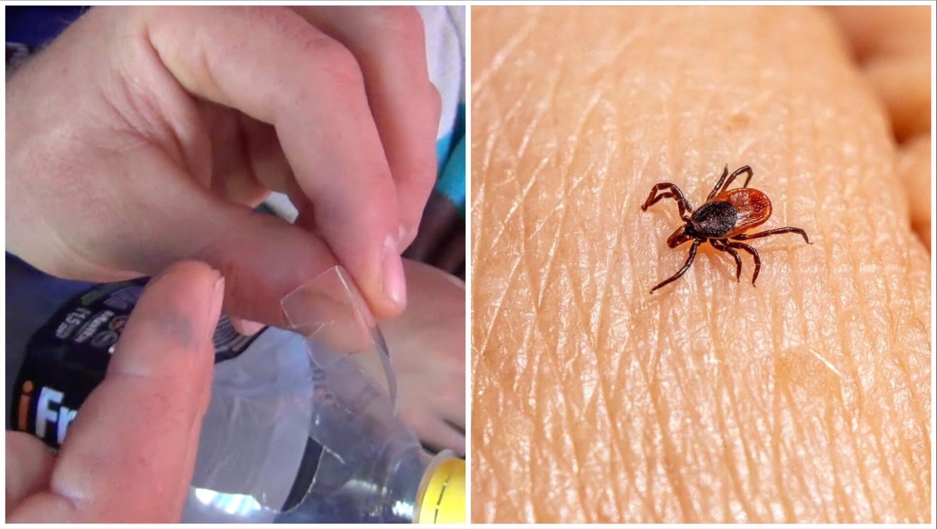 Господині розповіли, як дістати кліща зі шкіри за допомогою пляшки