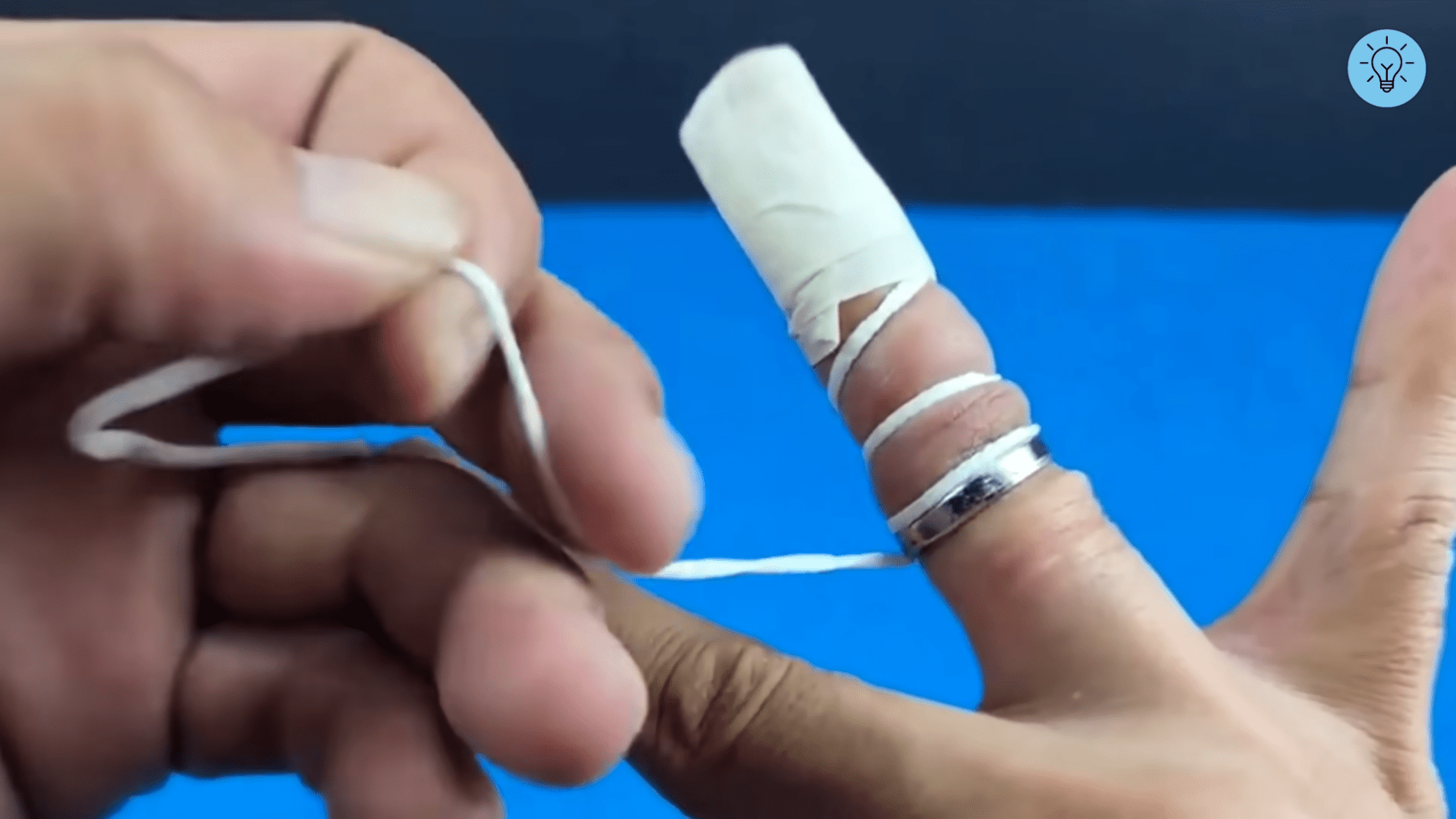 Експерти розповіли, як зняти каблучку, яка застрягла на пальці	