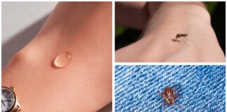 Господарі розповіли, який бюджетний засіб захищає від кліщів та комарів 