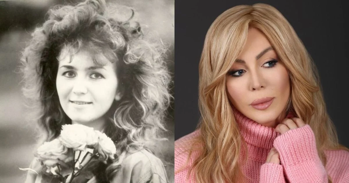 Ірина Білик показала фото до пластичних операцій. Фото: з відкритих джерел 