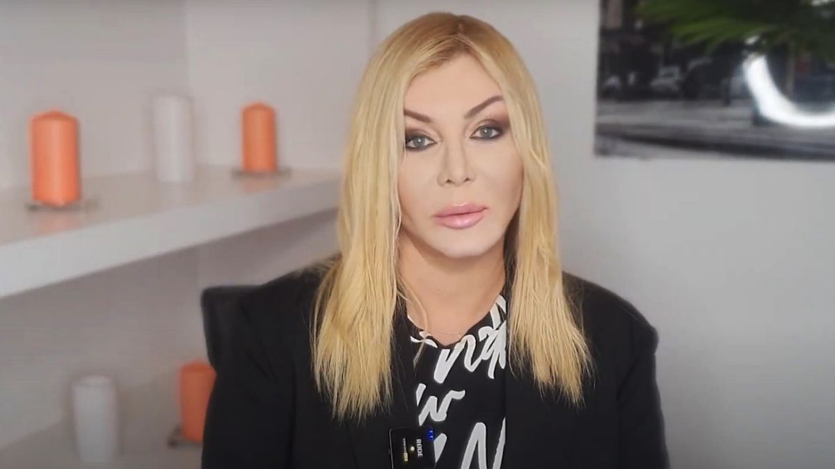 Ірина Білик показала фото до пластичних операцій. Фото: з відкритих джерел 