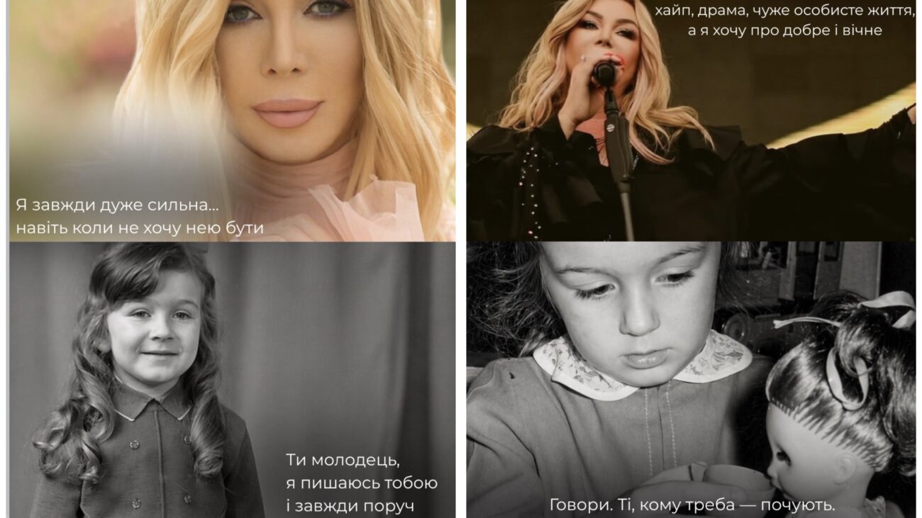 Ірина Білик показала фото до пластичних операцій. Фото: Instagram bilyk_iryna  